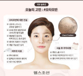 눈 주위 넓게 퍼진 푸른 반점… 오타모반, 치료될까?