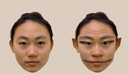 “사람 얼굴, 피카소 그림처럼 찌그러져 보여”… 전세계 100건 보고된 희귀병, 뭘까?