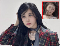 “예전에는 흑채 썼다” 이채연, 모발이식 고백… 전후 모습 봤더니?