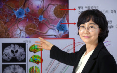 “노인 10명 중 1명 앓는 치매, 원인 치료제 10년 내 나올 것”