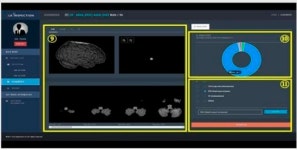 식약처, 국내 기업 2곳 개발 AI 기반 의료기기 판매 허가