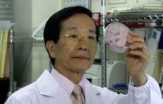 [명의를 찾아서] 강현재 서울대의대 교수 “혈압만 보다 콜레스테롤에 당한다… 혈관질환 국내 사망원인 2위”