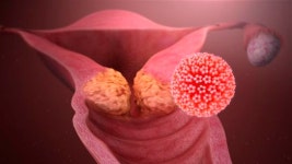 “치료제 없는 HPV,  mRNA로 치료 가능성 확인했다”