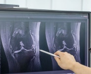 [메드테크, 우리가 국대다]④ 페북·뉴욕대 개최 MRI영상 딥러닝 대회 1위 휩쓴 저력...“이제 MRI 세계 시장은 우리 것”