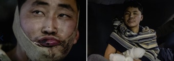 국정원 “우크라 생포 북한군, 상당수 병력 손실 있다고 진술”
