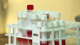 신규확진 4만6766명…전주대비 1만여명 감소