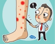 [이지스 한의원과 함께하는 건강 365] 잦은 스트레스·과로가 ‘자반증’ 부른다