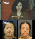 선풍기 아줌마 성형 전 사진 “거기서 멈췄어야 했는데…” 한탄