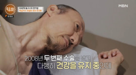 ‘희귀 유전병’ 한기범 “사업실패→집 3채 날려, 子 경계성 자폐 스펙트럼” [종합]