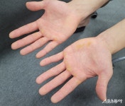 “무조건 뒷받침 되어야죠” KIA 김도영, 굳은살 가득한 손이 말하는 노력