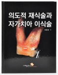 분당서울대병원 치과 최용훈 교수, ‘의도적 재식술과 자가치아 이식술’ 출간