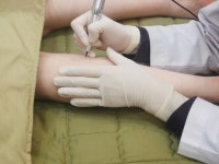 튼살치료, 저렴한 비용으로 효과 보려면?