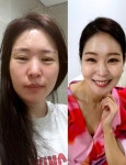 ‘김태현♥’ 미자, 부기 가득+쌩얼 과감 공개…“완전 다른 사람”