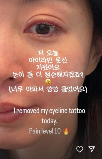 한예슬, 아이라인 문신 제거…“아파서 펑펑 울어”