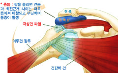 [메디컬 리포트] 커리도 괴롭힌 어깨 탈구, 어떤 부상일까?
