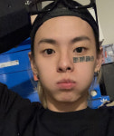 공황장애 칠린호미, 치료 위해 입원 [공식입장]
