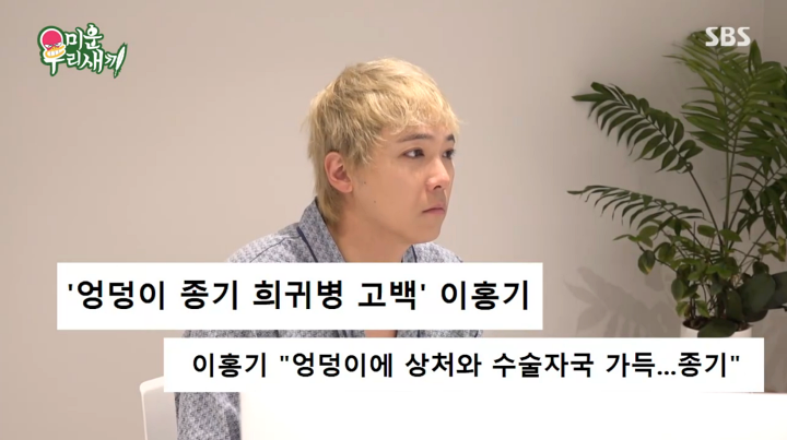 가수 이홍기, 20년간 투병한 희귀 질환 고백! 화농성 한선염으로 고통 호소