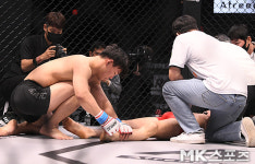 '본 플루 초크'에 기절한 이정현을 걱정하는 김진국 [MK포토]