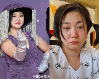 “저는 괜찮아요”...박나래, 급히 성대 수술 후 전한 몸 상태(전문)