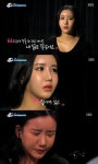 sbs 백투마이페이스 안세연 성형을 계속 하게된 이유 알고보니?