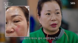 [꼬꼬무 찐리뷰]마약·태반 들었다? 소문 무성했던 전설의 선약국 화상연고…30년 만에 밝혀진 실체