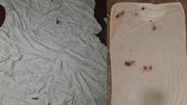 호텔서 코피 묻힌 이불… 세탁하니 지워지는데 32만원 배상 요구?