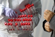오미크론까지 한번에… 한국, 세계 첫 만능 PCR 시약 개발 성공