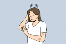 팔에 멍 달고 산 쯔양… 해외 구독자는 이미 알고 있었다