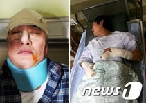 현대차 관리자와 하청노조원 충돌....수십명 부상