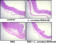 세계김치연구소, 김치 유산균 기술이전 계약 체결