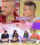 안녕하세요 프니엘, 탈모 호전 소식 전해 그때 고백 후 많이 좋아졌다