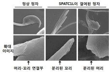 정자의 머리-꼬리 잇는 특이 단백질 발견…남성 불임 원인 진단
