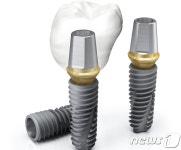 오스템임플란트, 임플란트 픽스쳐 판매량 전세계 1위 비결은