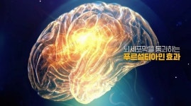 ‘치매’에 대한 오해와 진실…정확히 알고 대비해야