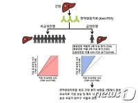 분당차병원, 간암 면역항암제 주의필요한 환자 선별 실마리 찾아