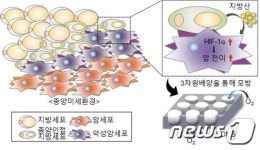 지방세포의 지방산, 암세포 전이 심화시킨다