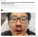 중국인 바이러스 나가라…英에서 대낮 동양인 상대 무차별 폭행