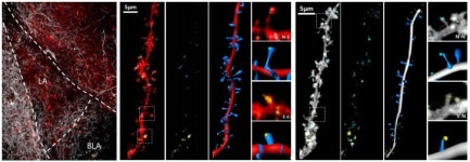 망각은 신의 배려…잊고 싶은 기억, 어떻게 하면 지울 수 있을까