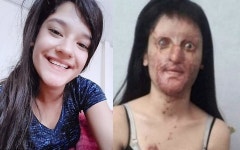 나 말고 아무도 못가져…염산 테러한 전남친 프러포즈 받아준 여성