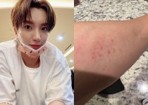 슈주 이특, 대상포진 호소…아무것도 하지 말고 쉬어야