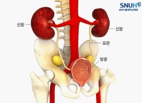 [생생 건강정보] 여성보다 남성이 잘 걸리는 방광암…원인은 이것
