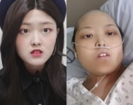 '21세 난소암' 유튜버 꾸밍, 시한부 선고 후 마지막 인사…"길면 한달"