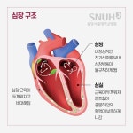 [생생 건강정보] 불규칙한 심장 박동 심방세동 의심…뇌졸중 유발도