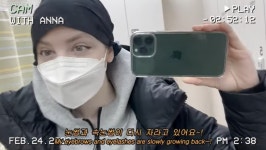 박주호♥ 안나 눈썹도 다시 자라고 있다…암투병 중 밝은 근황