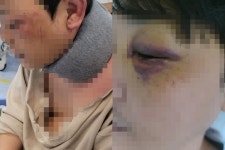 김포 아빠 폭행남은 조폭…버러지 같은 XX 엄태웅의 분노