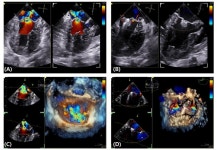 고려동물메디컬센터 강아지 심장병 수술 성과, 국제 학술지 등재