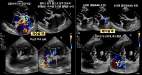 심장약 없이 산다…넬동물의료센터 개심술 후 단약율 100%