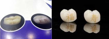 중국서 치아 문신 유행…연인끼리 이니셜 새기기도