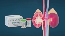 [속보] 식약처, 코오롱생명과학 인보사 허가취소·형사고발 