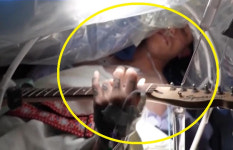 [영상] 의사의 제안...뇌수술하는 동안 기타연주 해주길